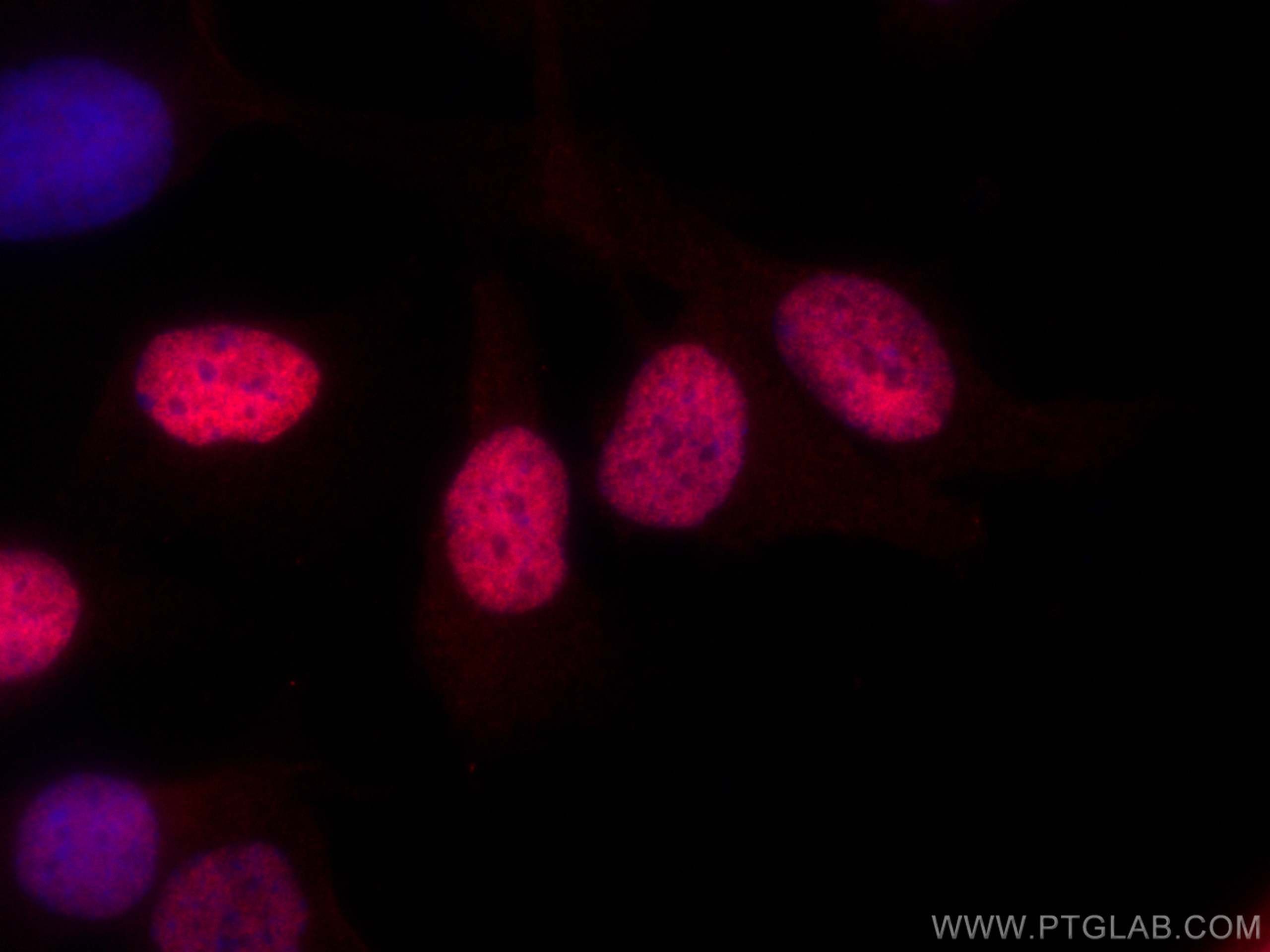 Immunofluorescence (IF) / fluorescent staining of SKOV-3 cells using EVI1 Polyclonal antibody (23201-1-AP)