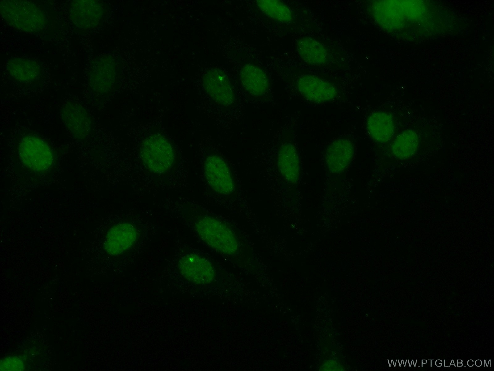 Immunofluorescence (IF) / fluorescent staining of SKOV-3 cells using EVI1 Polyclonal antibody (23201-1-AP)