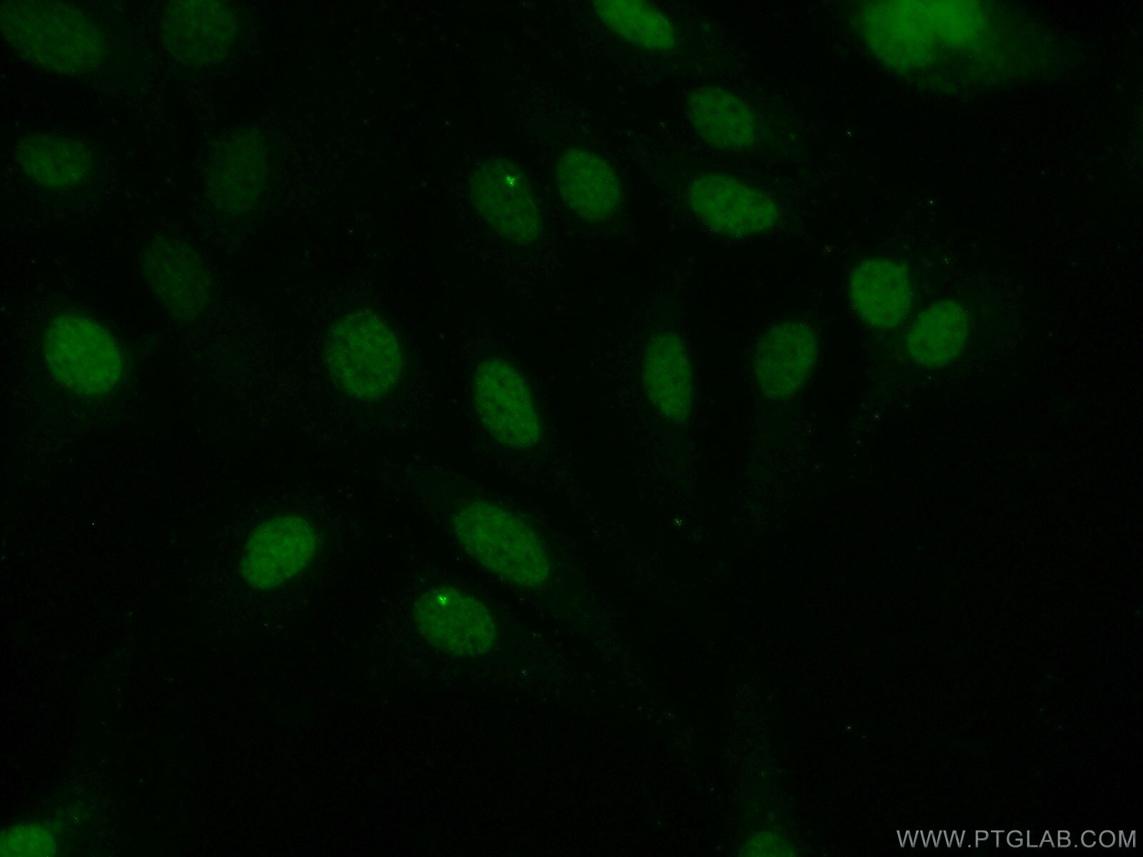 Immunofluorescence (IF) / fluorescent staining of SKOV-3 cells using EVI1 Polyclonal antibody (23201-1-AP)