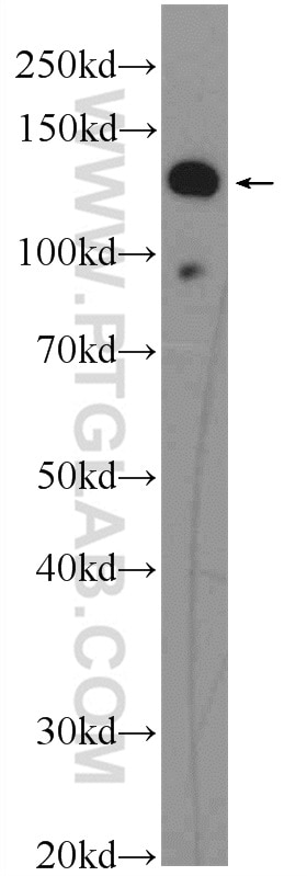 Western Blot (WB) analysis of SKOV-3 cells using EVI1 Polyclonal antibody (23201-1-AP)