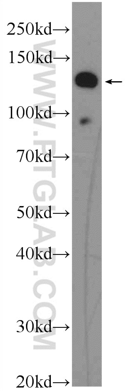 WB analysis of SKOV-3 using 23201-1-AP