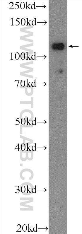 Western Blot (WB) analysis of SKOV-3 cells using EVI1 Polyclonal antibody (23201-1-AP)