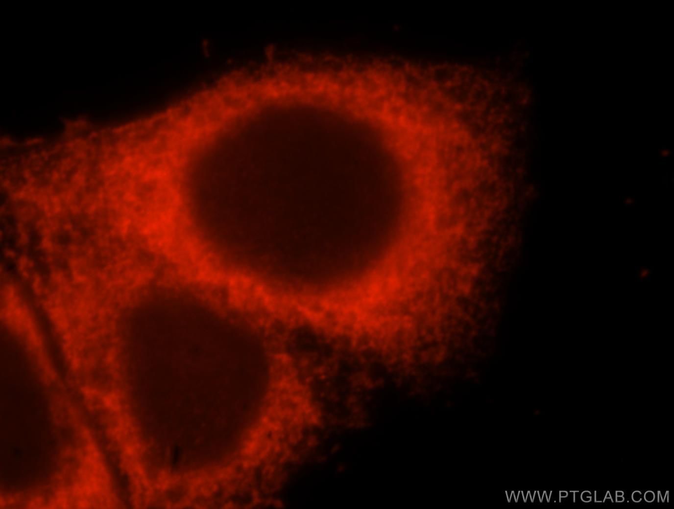 Immunofluorescence (IF) / fluorescent staining of HepG2 cells using EVI2A Polyclonal antibody (17415-1-AP)