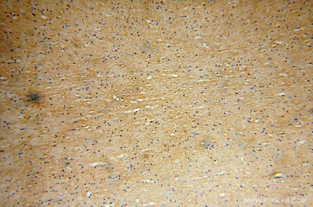 Immunohistochemistry (IHC) staining of human brain tissue using EVI2A Polyclonal antibody (17415-1-AP)