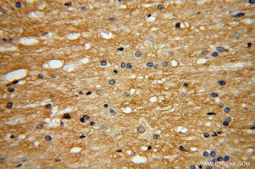 Immunohistochemistry (IHC) staining of human brain tissue using EVI2A Polyclonal antibody (17415-1-AP)