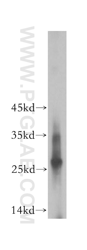 Western Blot (WB) analysis of human brain tissue using EVI2A Polyclonal antibody (17415-1-AP)