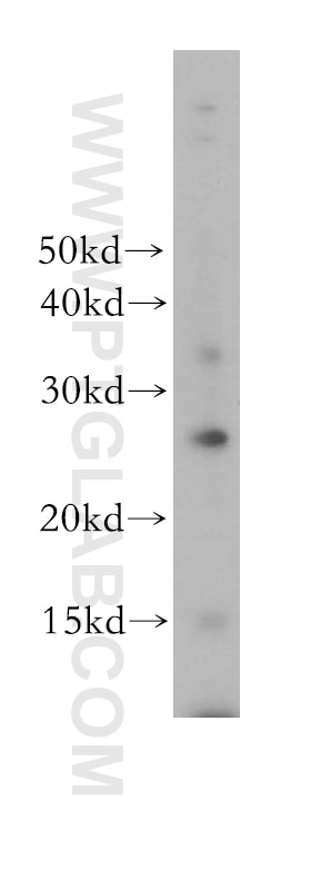 Western Blot (WB) analysis of human brain tissue using EVI2A Polyclonal antibody (17415-1-AP)