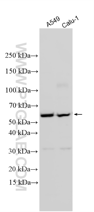 Western Blot (WB) analysis of various lysates using EVI2B Polyclonal antibody (24891-1-AP)