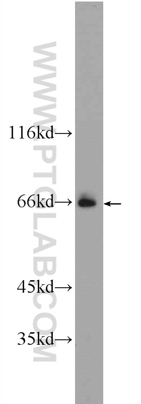 Western Blot (WB) analysis of A549 cells using EVI2B Polyclonal antibody (24891-1-AP)