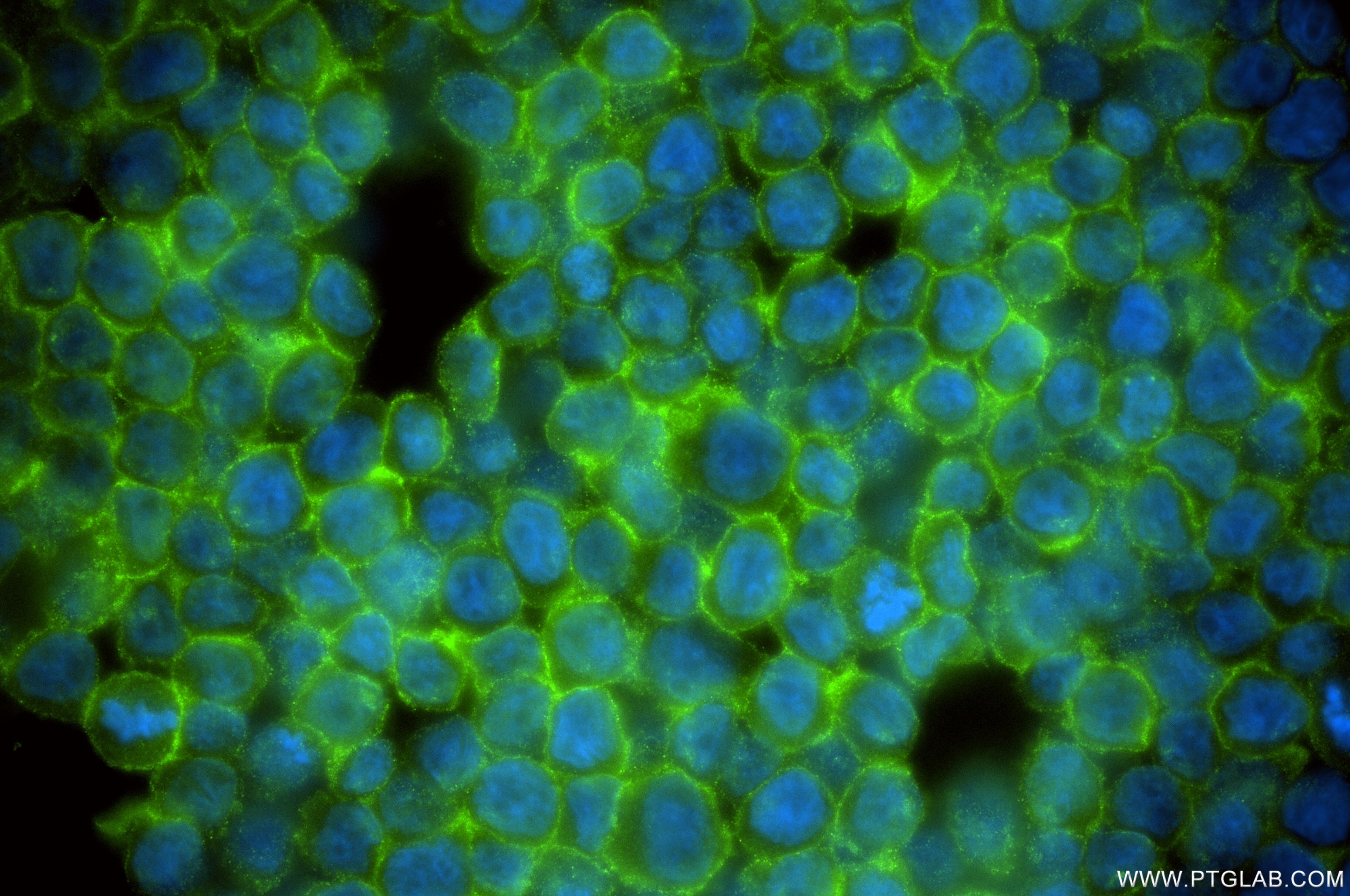 Immunofluorescence (IF) / fluorescent staining of THP-1 cells using EVI2B Recombinant antibody (85943-1-RR)