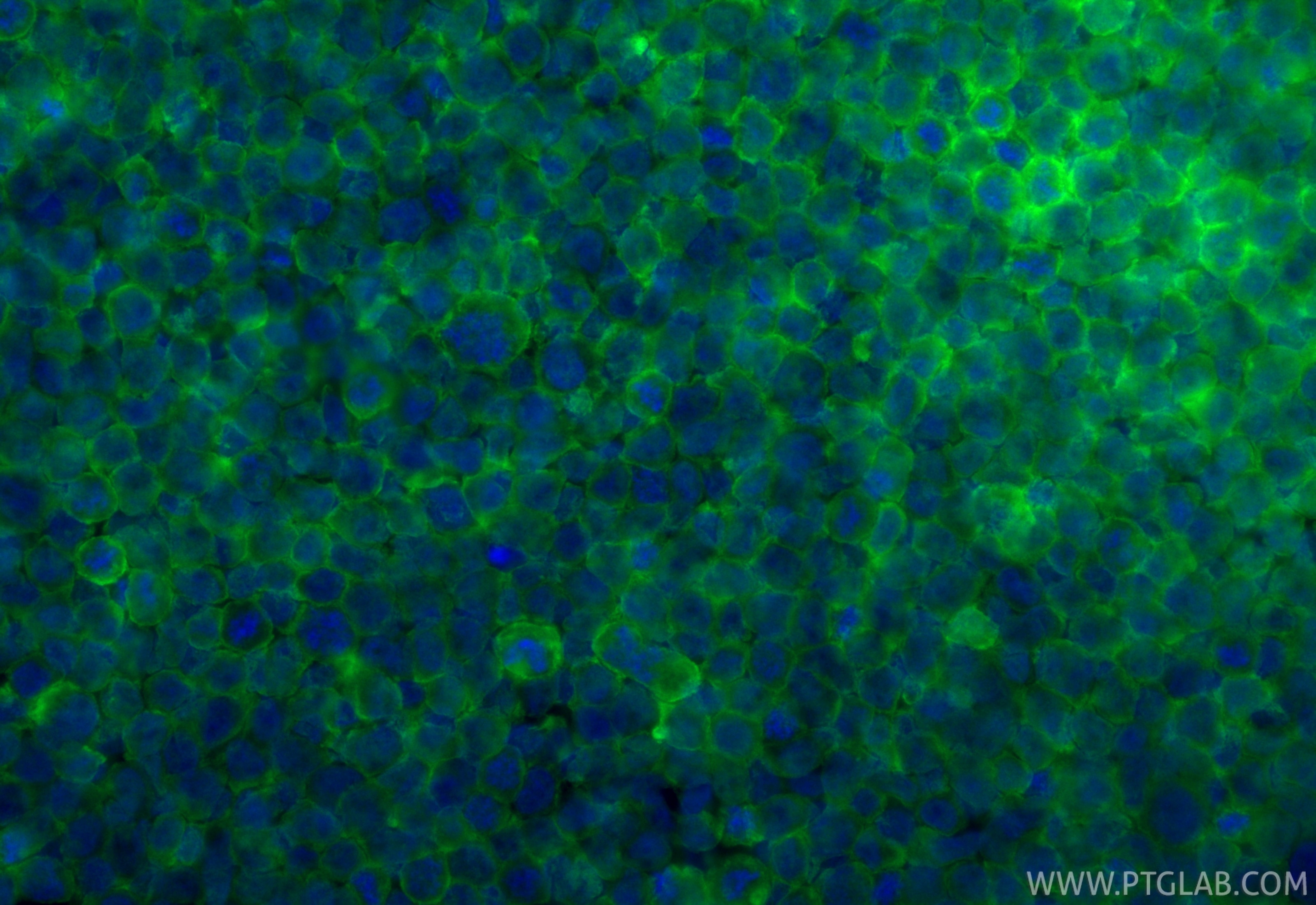 Immunofluorescence (IF) / fluorescent staining of THP-1 cells using CoraLite® Plus 488-conjugated EVI2B Recombinant mo (CL488-85943)
