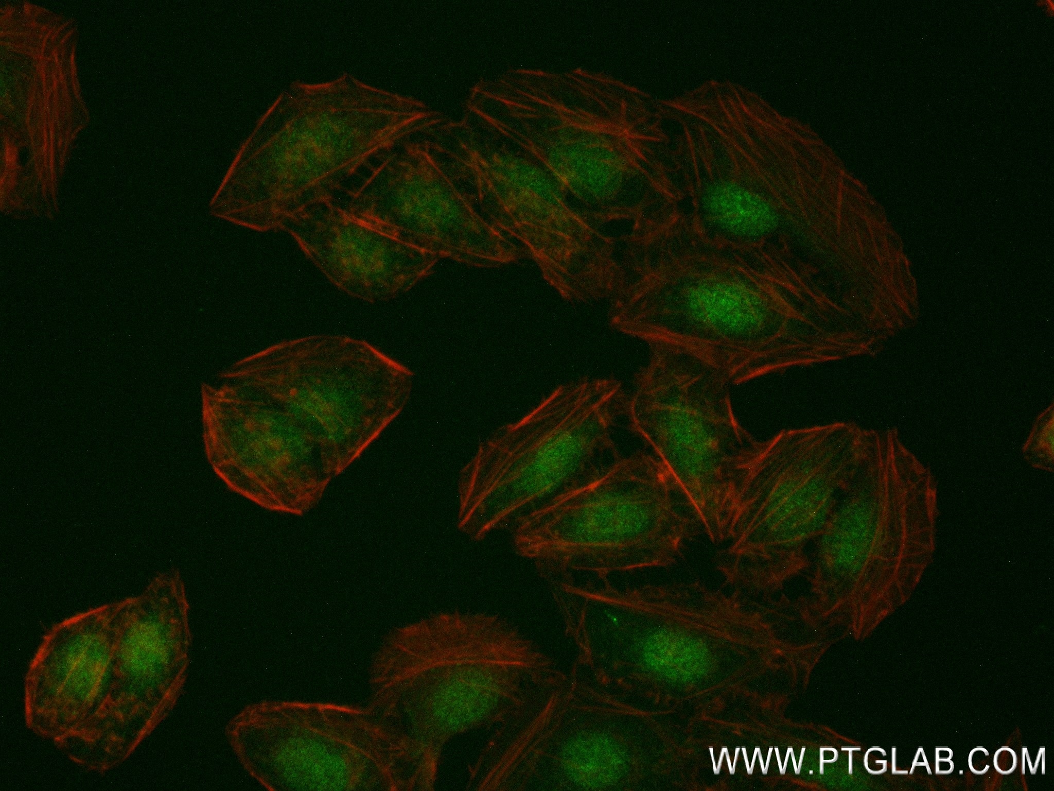 Immunofluorescence (IF) / fluorescent staining of U2OS cells using EVI5 Recombinant antibody (84738-2-RR)