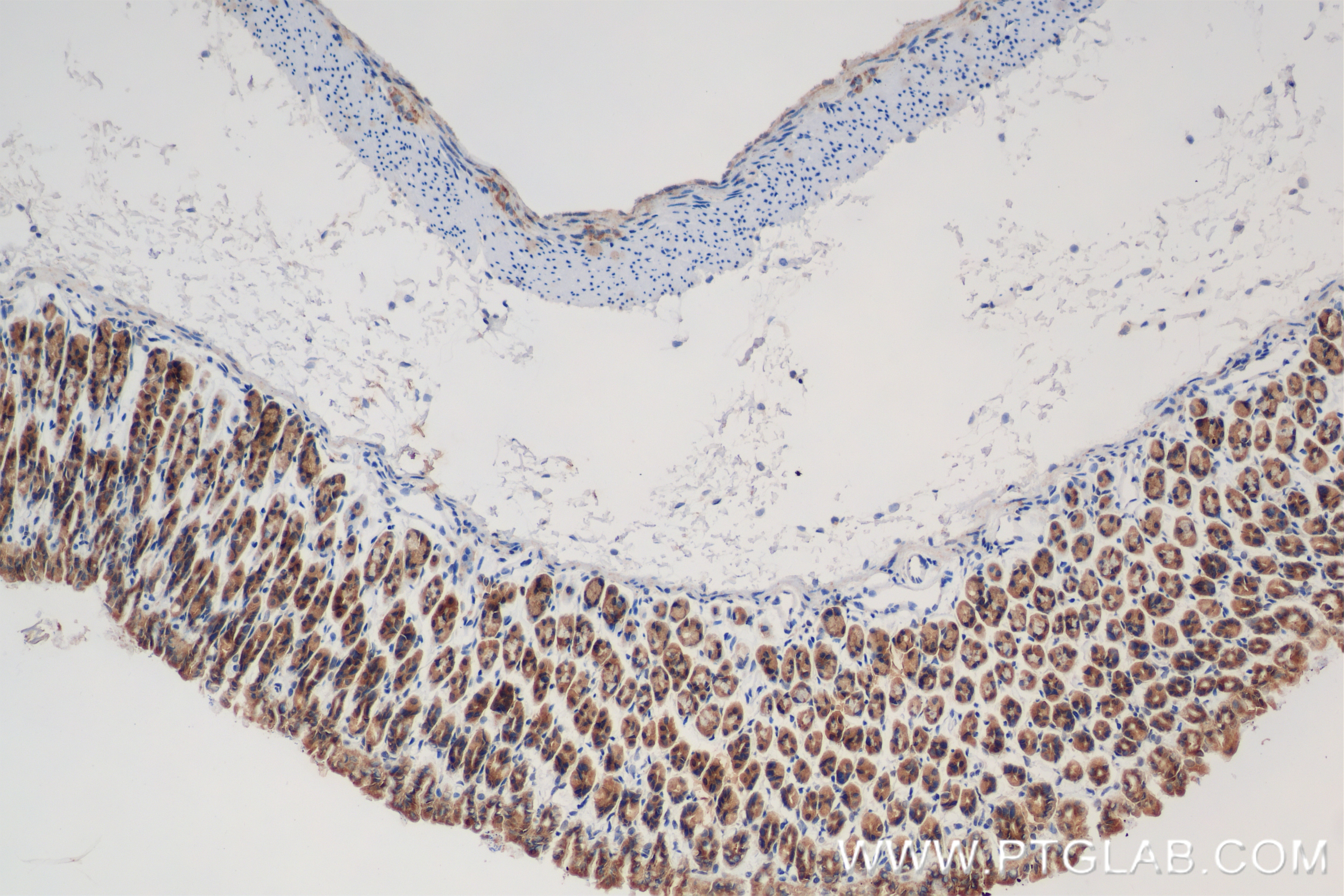 Immunohistochemistry (IHC) staining of mouse stomach tissue using EVI5 Recombinant antibody (84738-2-RR)