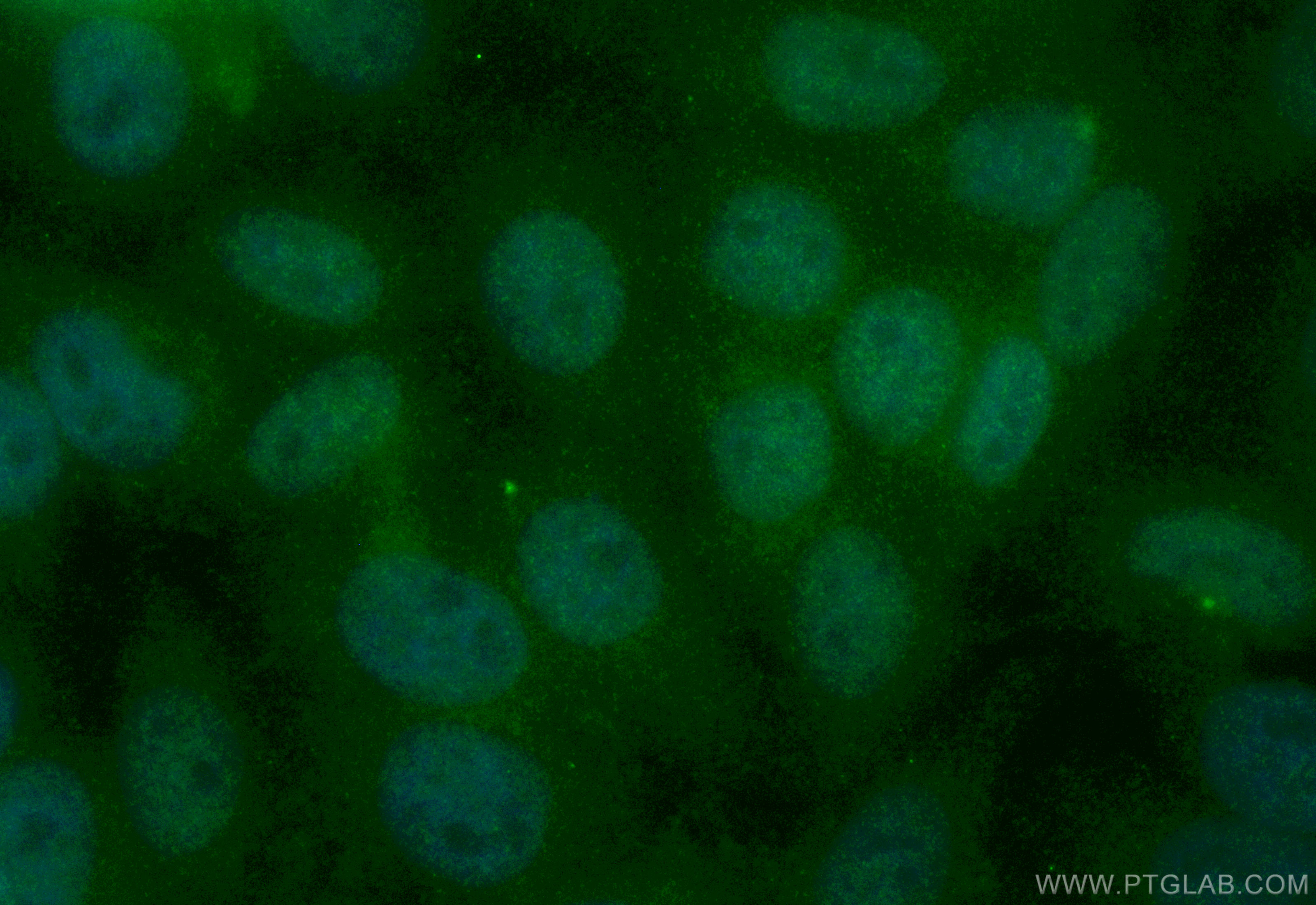 Immunofluorescence (IF) / fluorescent staining of HepG2 cells using CoraLite® Plus 488-conjugated EVI5 Recombinant ant (CL488-84738-2)