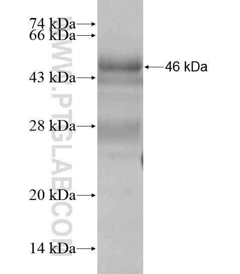 EVI5 fusion protein Ag18937 SDS-PAGE EVI5 fusion protein Ag18937 SDS-PAGE