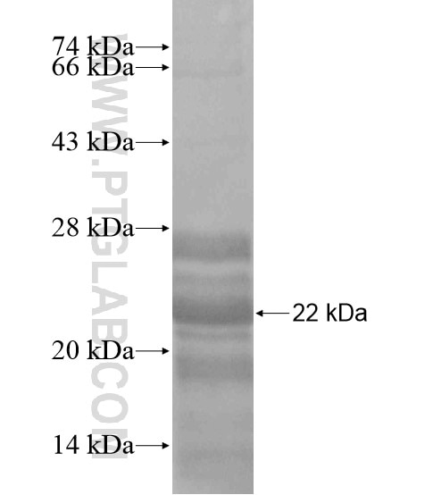 EVI5 fusion protein Ag19580 SDS-PAGE