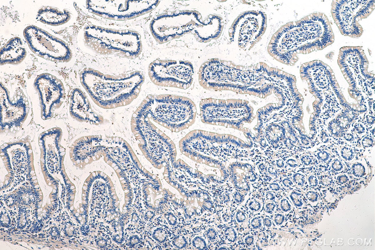 Immunohistochemistry (IHC) staining of human small intestine tissue using EVL Polyclonal antibody (13484-1-AP)