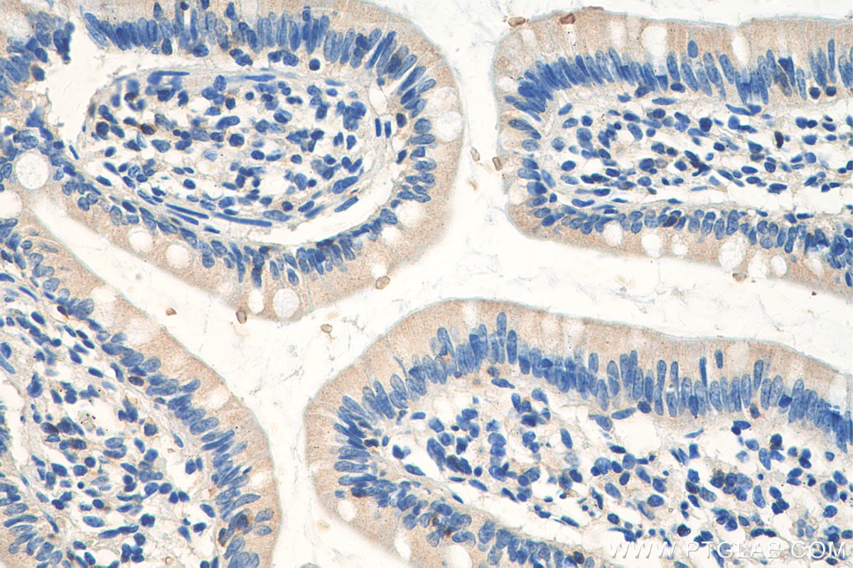 Immunohistochemistry (IHC) staining of human small intestine tissue using EVL Polyclonal antibody (13484-1-AP)
