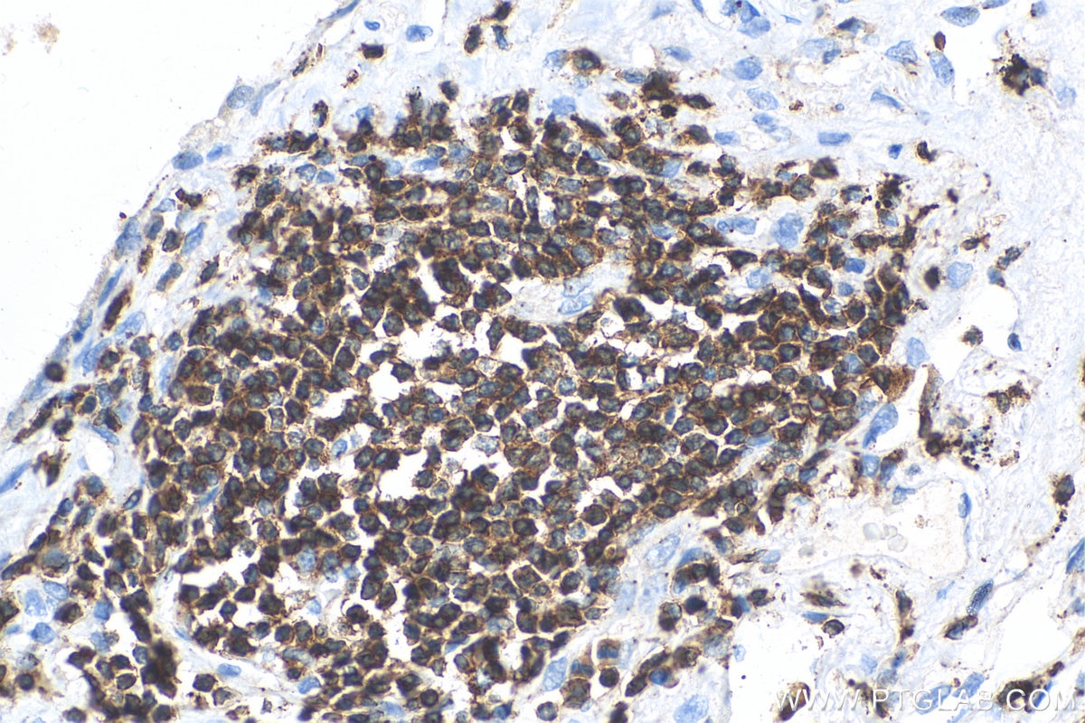 Immunohistochemistry (IHC) staining of human lung tissue using EVL Polyclonal antibody (13484-1-AP)