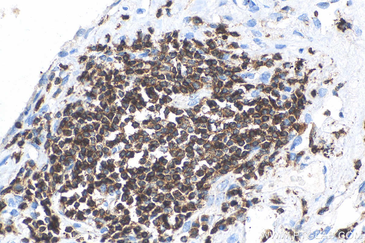 IHC staining of human lung using 13484-1-AP