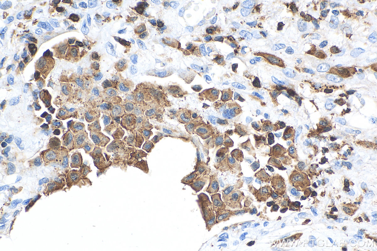 Immunohistochemistry (IHC) staining of human lung tissue using EVL Polyclonal antibody (13484-1-AP)