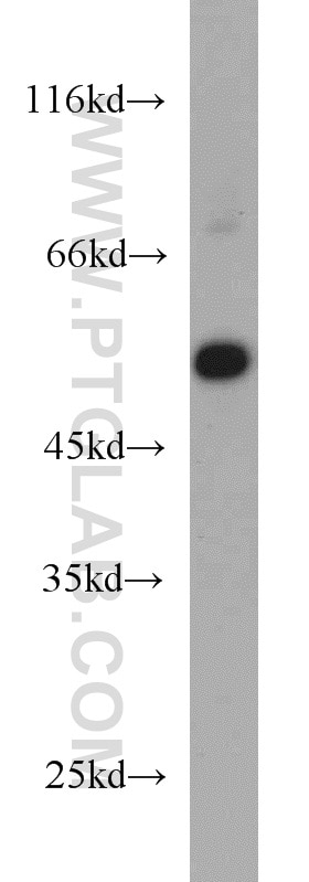 Western Blot (WB) analysis of Jurkat cells using EVL Polyclonal antibody (13484-1-AP)