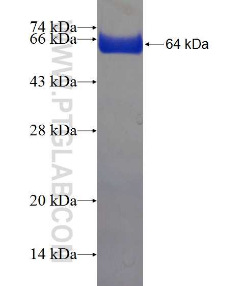 EVPL fusion protein Ag22188 SDS-PAGE