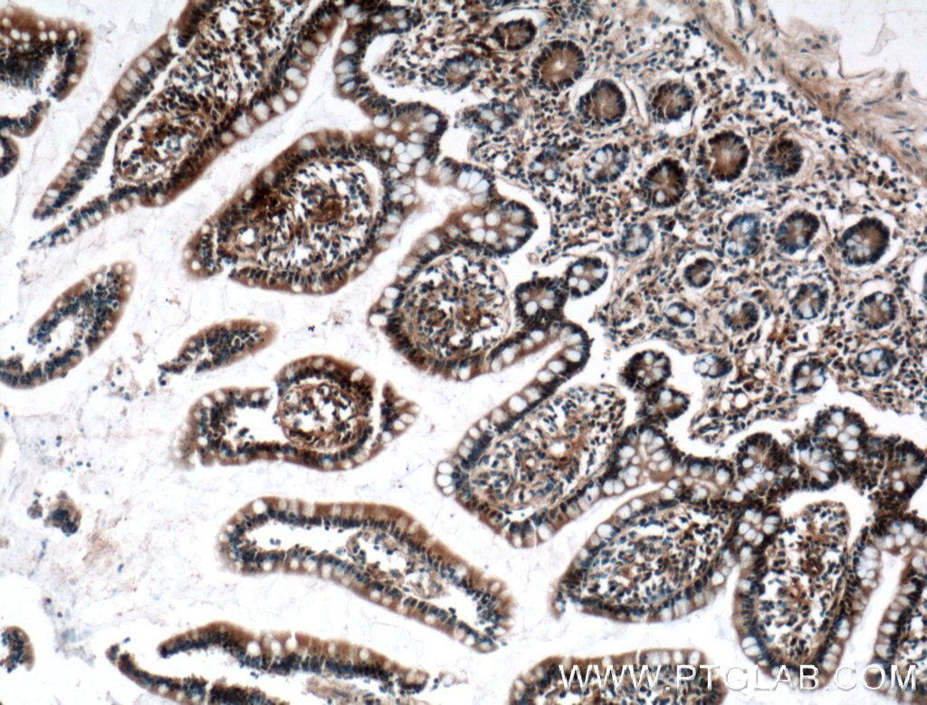 Immunohistochemistry (IHC) staining of human small intestine tissue using EWS Polyclonal antibody (55191-1-AP)