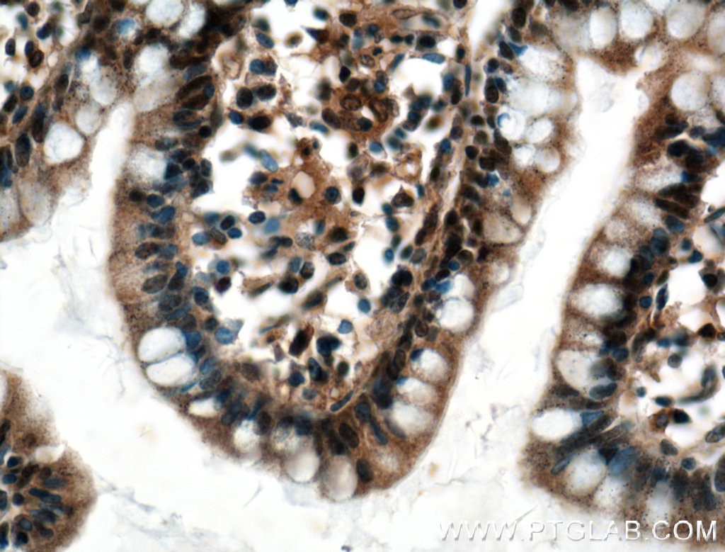 Immunohistochemistry (IHC) staining of human small intestine tissue using EWS Polyclonal antibody (55191-1-AP)