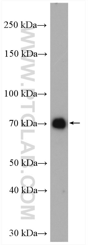 Western Blot (WB) analysis of mouse testis tissue using EWS Polyclonal antibody (55191-1-AP)