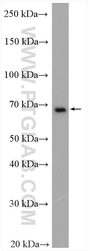 Western Blot (WB) analysis of Jurkat cells using EWS Polyclonal antibody (55191-1-AP)