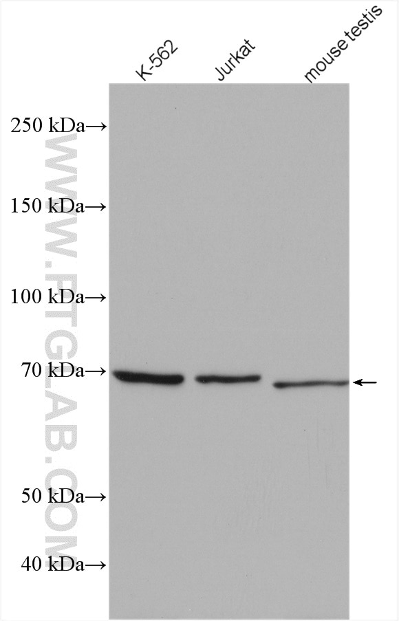 Western Blot (WB) analysis of various lysates using EWS Polyclonal antibody (55191-1-AP)