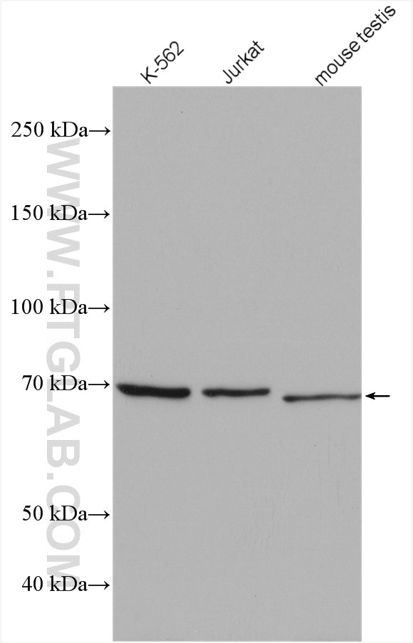 WB analysis using 55191-1-AP