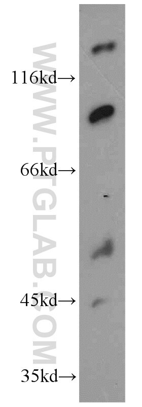 Western Blot (WB) analysis of Jurkat cells using EWS Polyclonal antibody (55191-1-AP)