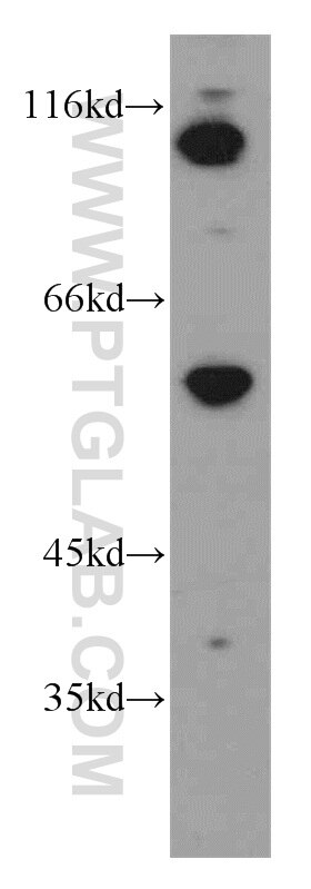 Western Blot (WB) analysis of K-562 cells using EWS Polyclonal antibody (55191-1-AP)