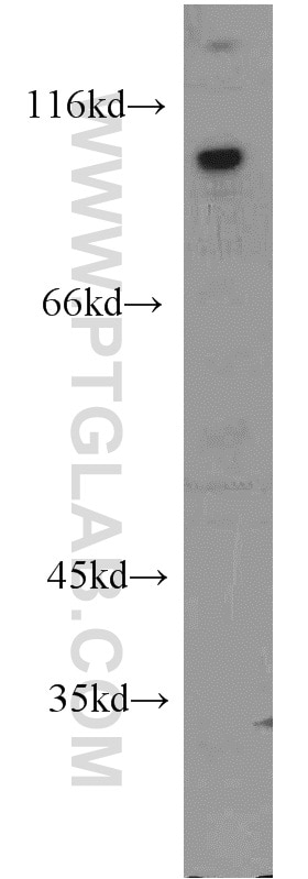 EWS Polyclonal antibody