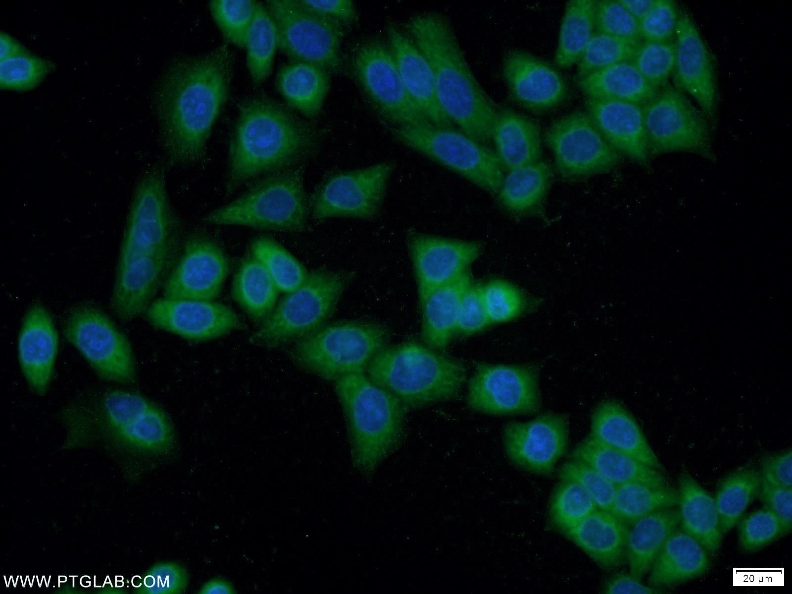 Immunofluorescence (IF) / fluorescent staining of HeLa cells using EXD1 Polyclonal antibody (17313-1-AP)