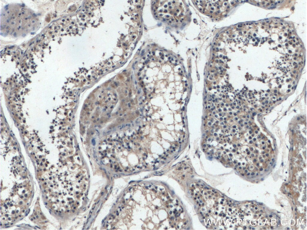 Immunohistochemistry (IHC) staining of human testis tissue using EXD1 Polyclonal antibody (17313-1-AP)