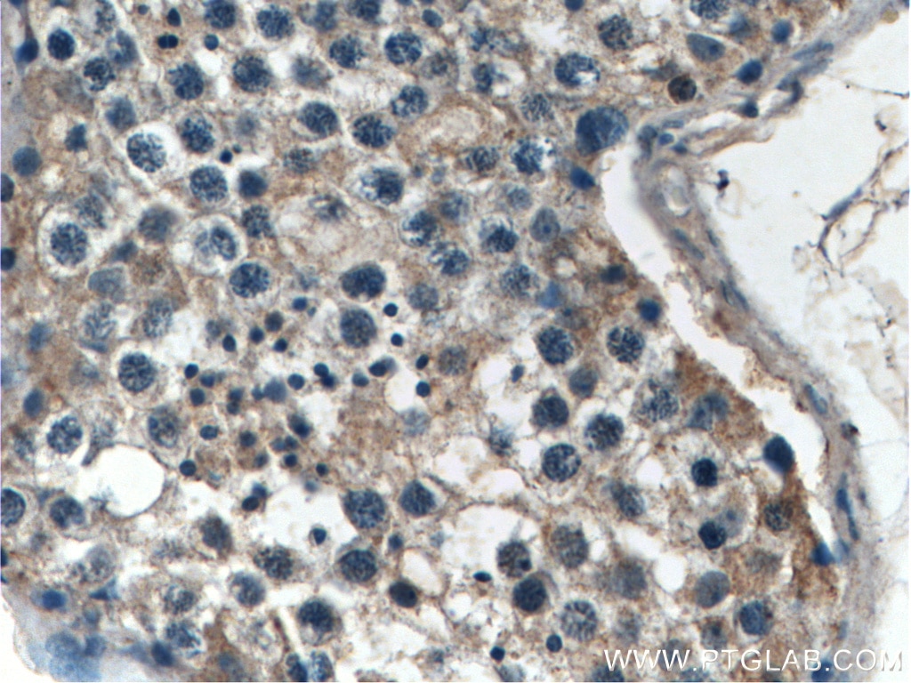 Immunohistochemistry (IHC) staining of human testis tissue using EXD1 Polyclonal antibody (17313-1-AP)