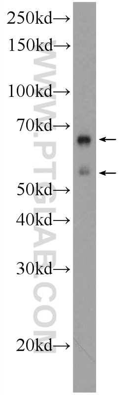 Western Blot (WB) analysis of SH-SY5Y cells using EXD1 Polyclonal antibody (17313-1-AP)