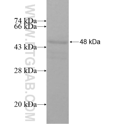 EXD1 fusion protein Ag11234 SDS-PAGE EXD1 fusion protein Ag11234 SDS-PAGE