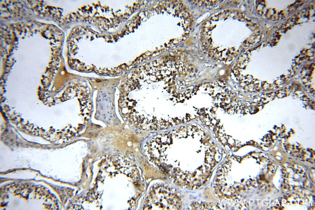 Immunohistochemistry (IHC) staining of human testis tissue using EXD2 Polyclonal antibody (20138-1-AP)