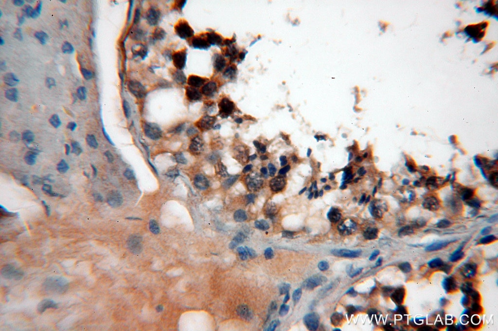Immunohistochemistry (IHC) staining of human testis tissue using EXD2 Polyclonal antibody (20138-1-AP)