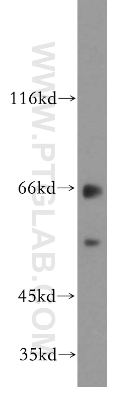 Western Blot (WB) analysis of mouse brain tissue using EXD2 Polyclonal antibody (20138-1-AP)