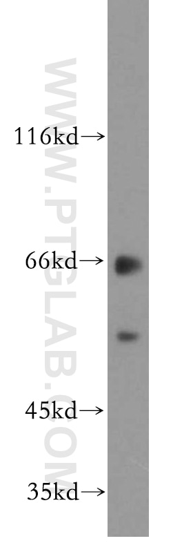 WB analysis of mouse brain using 20138-1-AP