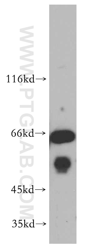 Western Blot (WB) analysis of mouse lung tissue using EXD2 Polyclonal antibody (20138-1-AP)