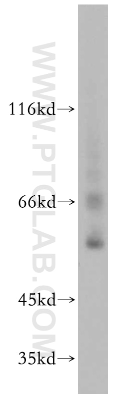 Western Blot (WB) analysis of mouse pancreas tissue using EXD2 Polyclonal antibody (20138-1-AP)