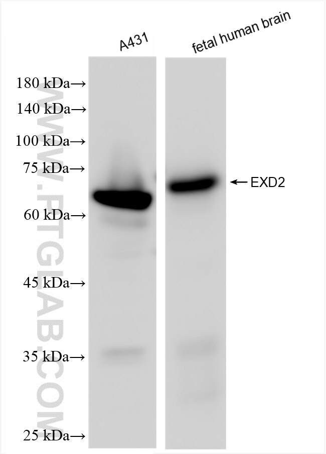 EXD2