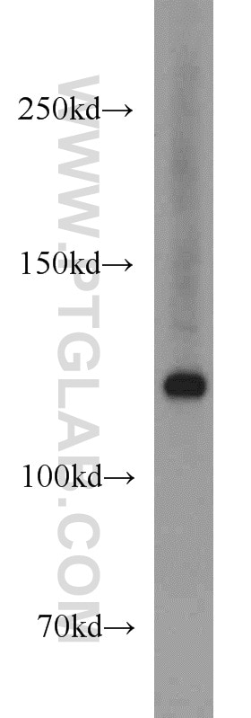 Western Blot (WB) analysis of Jurkat cells using EXO1 Polyclonal antibody (16253-1-AP)
