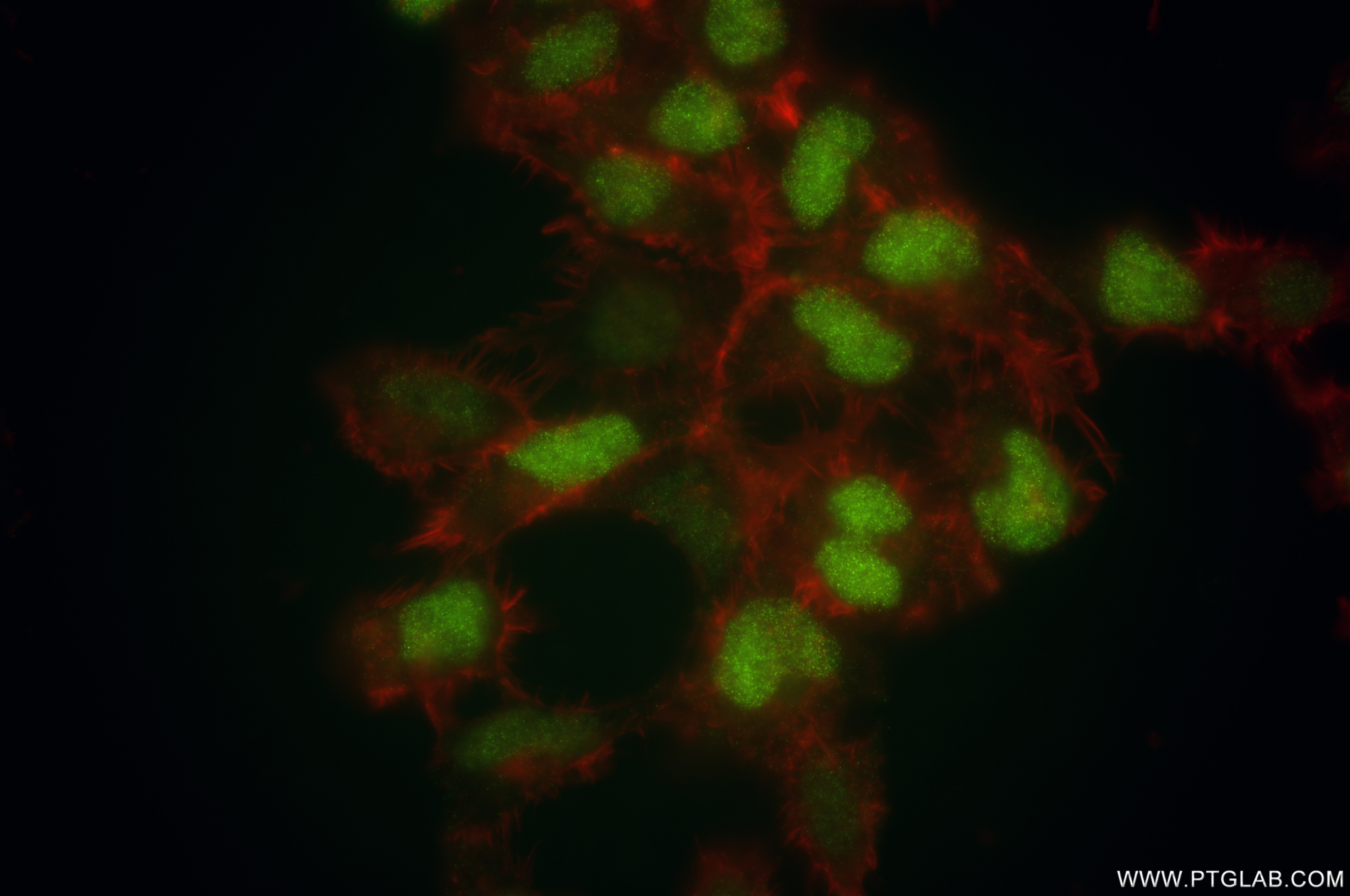 Immunofluorescence (IF) / fluorescent staining of HEK-293 cells using EXO1 Recombinant antibody (86445-1-RR)